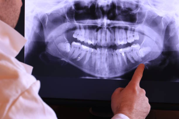 Best Emergency Root Canal Therapy in Wayland, IA